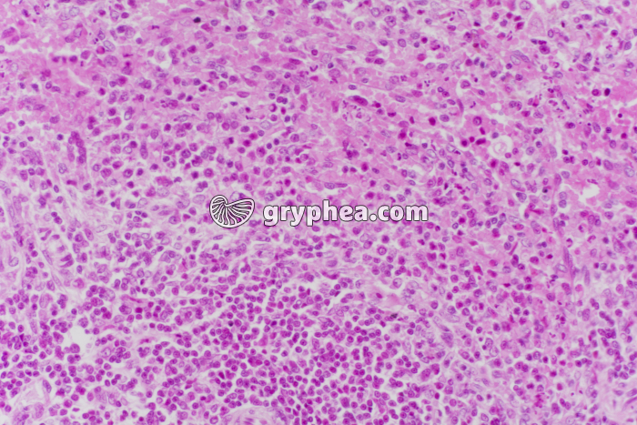 Ganglion lymphatique x50 - gryphea.org